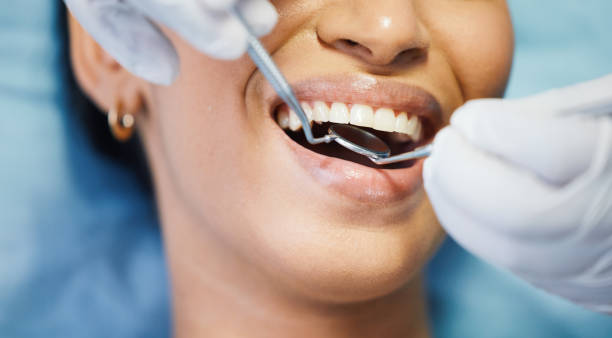 Best Walk-In Emergency Dentist in Canyon Lake, TX